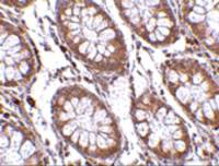 CCK4 antibody
