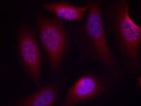 SEK1 / MKK4 (phospho Ser80) antibody