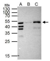 RFP antibody [GT1433]