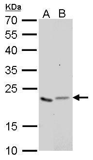 Glyoxalase I antibody [GT552]