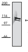 Dynamin 1 antibody [4E67]