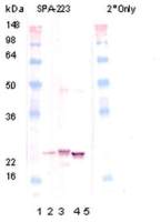 alpha B Crystallin antibody