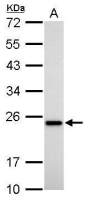Transgelin antibody [GT336]