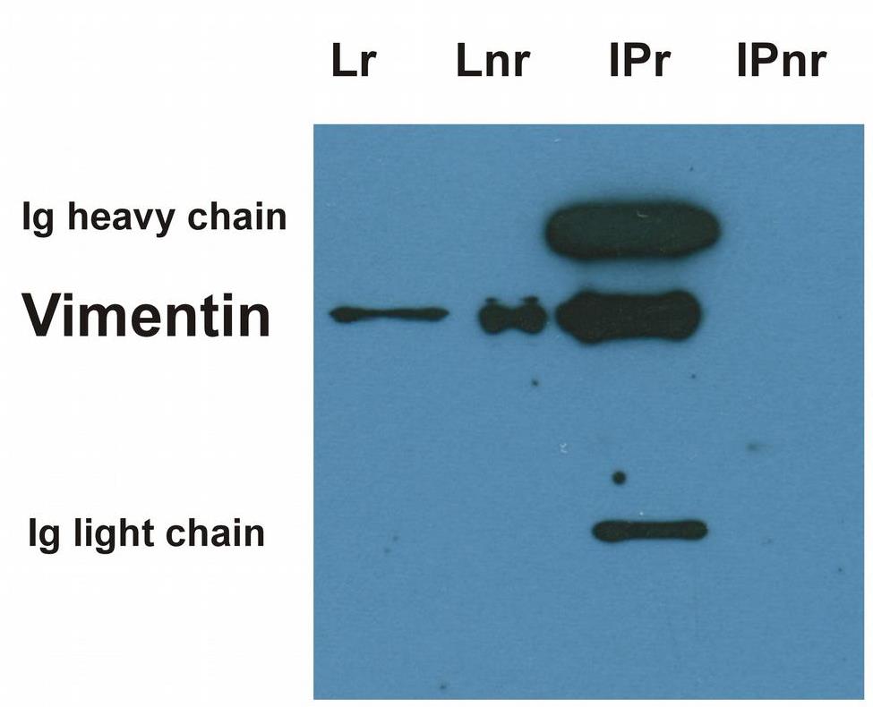 Vimentin antibody [VI-10]