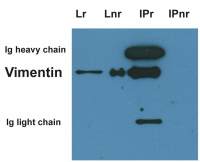 Vimentin antibody [VI-10]