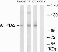 Sodium Potassium ATPase alpha 2 antibody