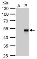 BMP8b antibody [GT1017]