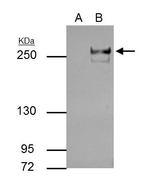 TET2 antibody [GT411]
