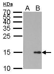Histone H2A.XS139ph (phospho Ser139) antibody [GT1021]