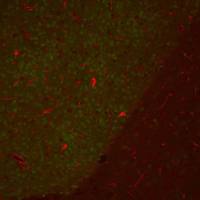 Choline Acetyltransferase antibody