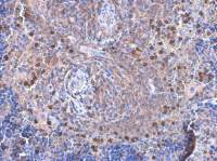 VAV1 antibody [GT557]