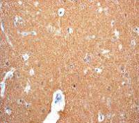 Tau (phospho Ser198) antibody [EPR2400]