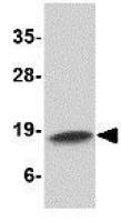 Cathelicidin antibody