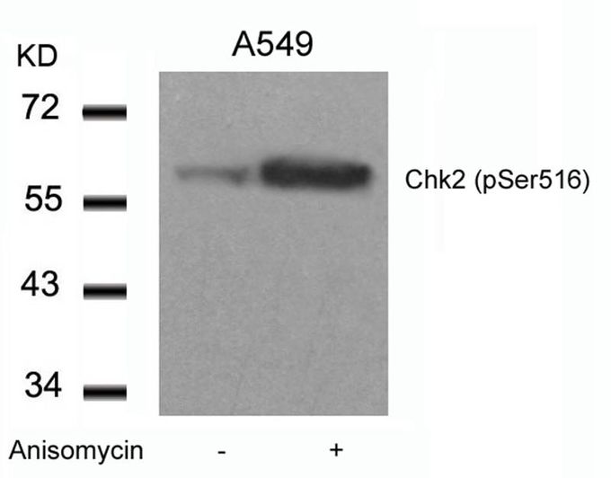 Chk2 (phospho Ser516) antibody