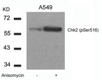 Chk2 (phospho Ser516) antibody