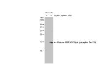 Histone H2A.XS139ph (phospho Ser139) antibody [HL1299]