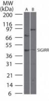 SIGIRR antibody