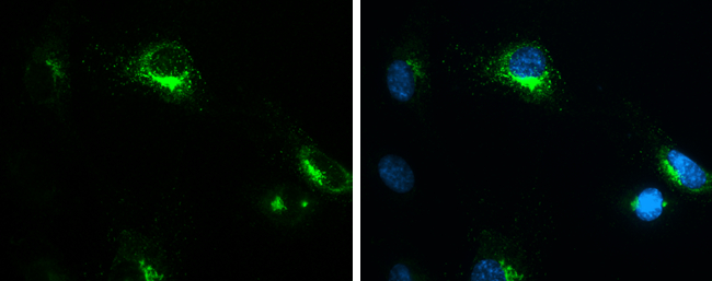 MMP1 antibody [GT2649]