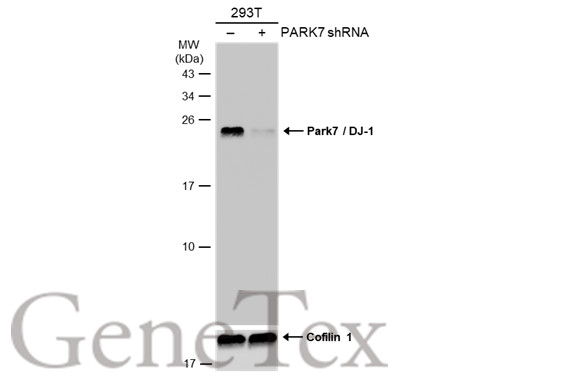 Park7 / DJ-1 antibody [GT136]