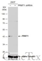 PRMT1 antibody [GT10111]