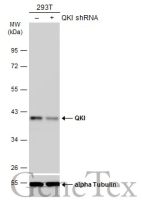 QKI antibody [GT228]
