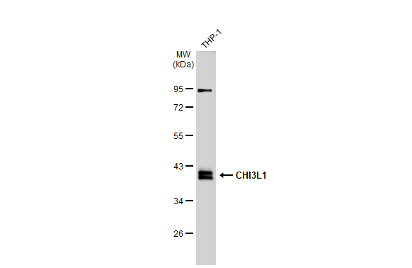 CHI3L1 antibody
