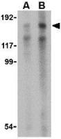 TRBP1 antibody