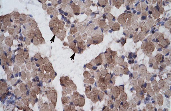 LHX9 antibody, C-term