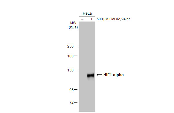 HIF1 alpha antibody [GT10211]