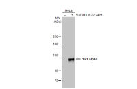 HIF1 alpha antibody [GT10211]