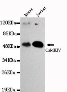 CaMKIV antibody [3C10-D5-G7]