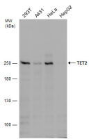 TET2 antibody [GT649]