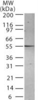 Presenilin 2 antibody [198C679.2.1]