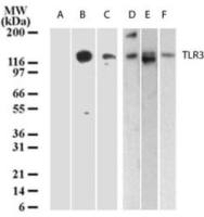 TLR3 antibody [40C1285.6]