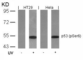 p53 (phospho Ser6) antibody