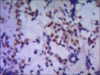 TBLR1 antibody [4F3-A8-D9]
