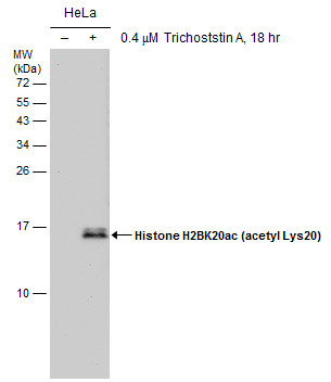 Histone H2BK20ac (acetyl Lys20) antibody [GT578]