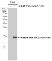 Histone H2BK20ac (acetyl Lys20) antibody [GT578]