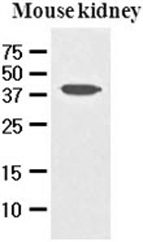 AVEN antibody [3G4]