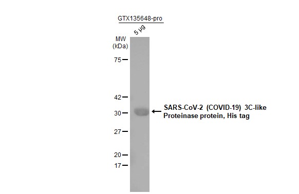 SARS-CoV-2 (COVID-19) 3CLpro (nsp5) protein, His tag