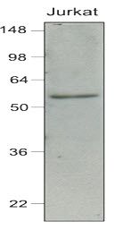 IRF7 antibody [3D9]