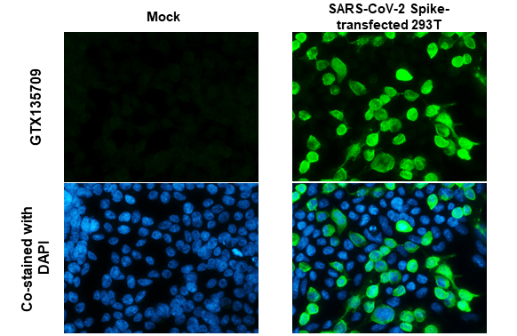 SARS-CoV-2 (COVID-19) Spike RBD antibody