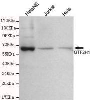 GTF2H1 antibody [3E8-D3-H8]