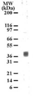 5-HT1B receptor antibody