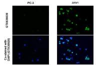 Androgen Receptor (ARv7 Splice Variant) antibody [HL1240]
