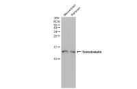 Somatostatin antibody [HL1101]
