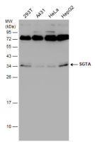 SGTA antibody [6A4]