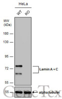 Lamin A + C antibody [GT9712]