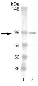 Estrogen Receptor alpha antibody [h-151]