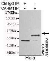 CARM1 antibody [2B9-H11-H10]